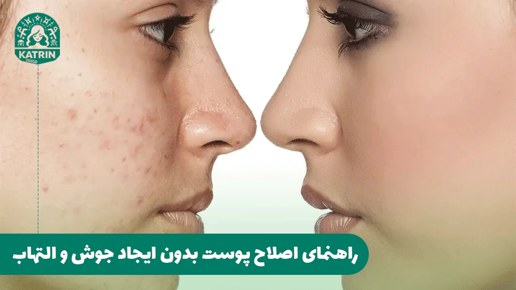 راهنمای اصلاح پوست بدون ایجاد جوش و التهاب