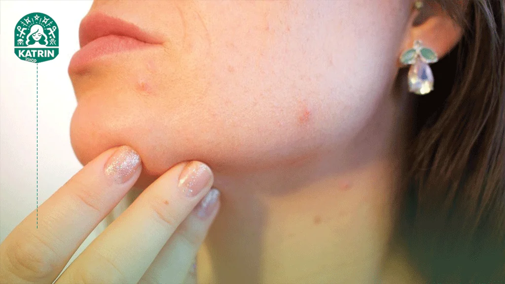 افزایش جوش و مشکلات پوستی