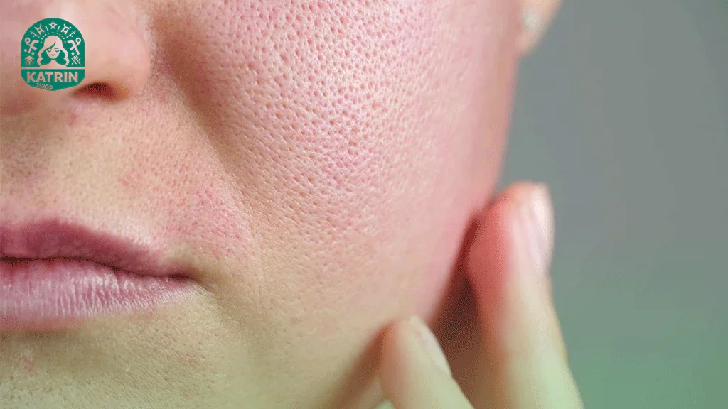 آرایش چگونه باعث مسدود شدن منافذ پوست می شود؟